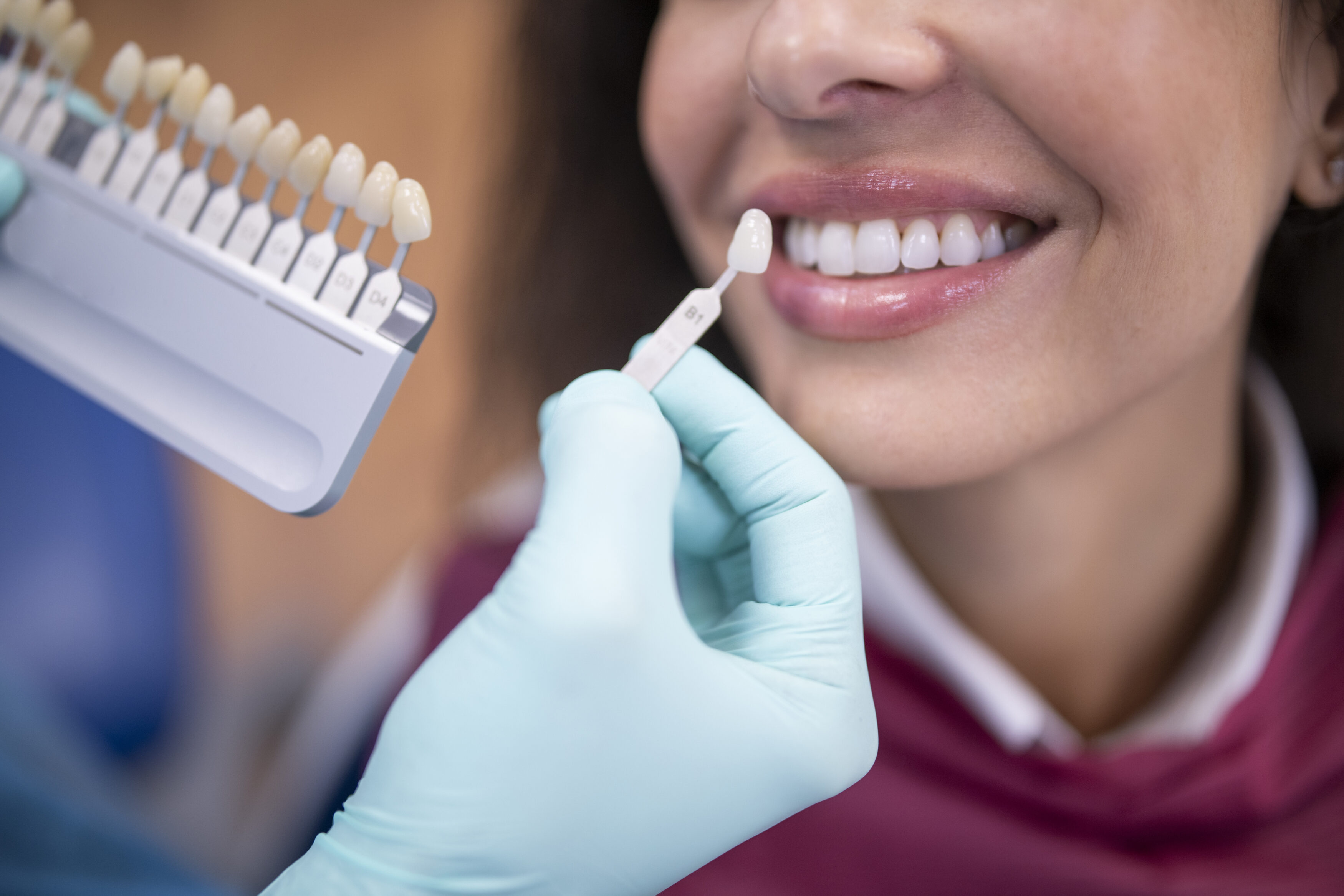 Crown your smile — how dental crowns can rescue your teeth